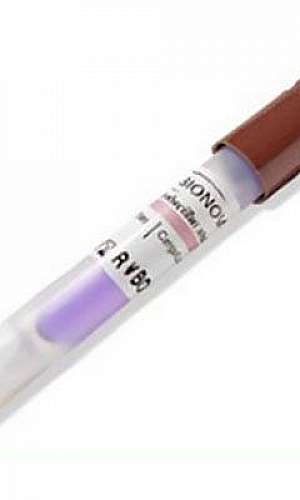 teste biológico teste biológico